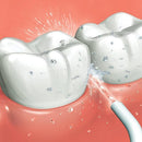 Irrigador Dental Inalámbrico Presión Hidráulica Uso Doméstico Para Limpieza Dental